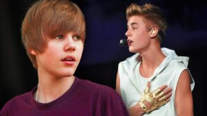 Has Justin Bieber Gone Through a Hair Transplant? Expert Gives Verdict Looking at His Before and After Pictures